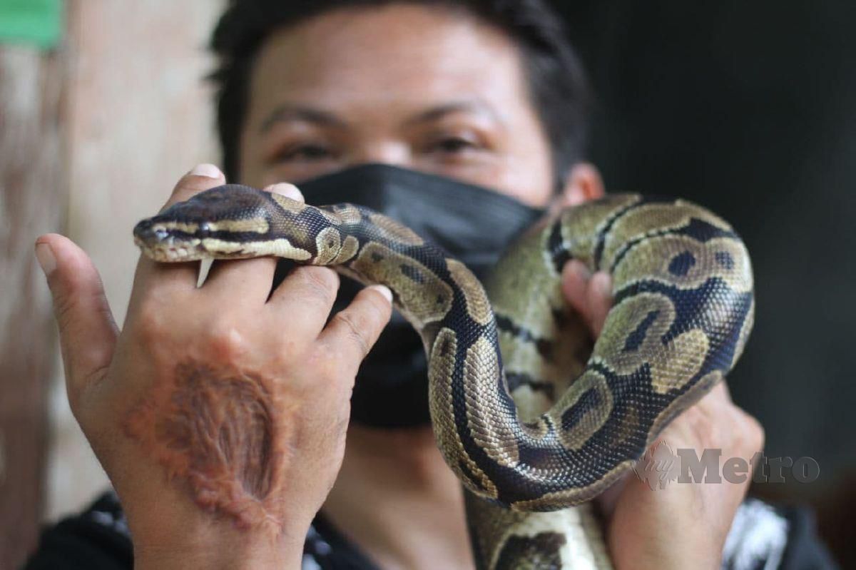 MOHD Fauzi menunjukkan parut akibat dipatuk ular berbisa. FOTO Nor Amalina Alias 