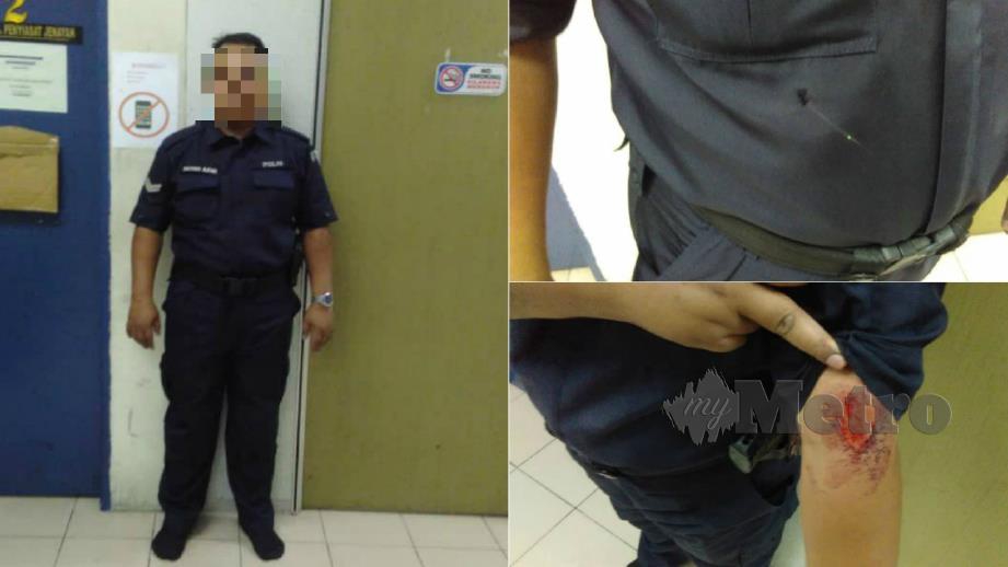 MOHD Azmi menerima tiga jahitan di perut akibat ditikam di perut dan lengan kiri dengan pemutar skru oleh seorang lelaki di kawasan IKS Malaysia-Kuwait, Permatang Tinggi Bukit Tengah di Bukit Mertajam. FOTO Ihsan Polis 