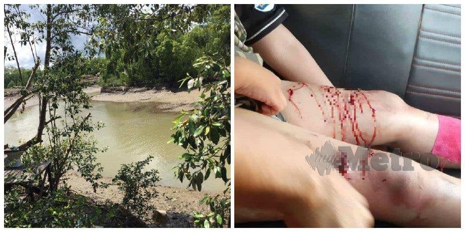  (Gambar kiri) Lokasi serangan buaya di Sungai Imam, Jambatan Dua, Kampung Bombalai. (Gambar kanan)  Mangsa mengalami kecederaan di paha. FOTO ihsan pembaca