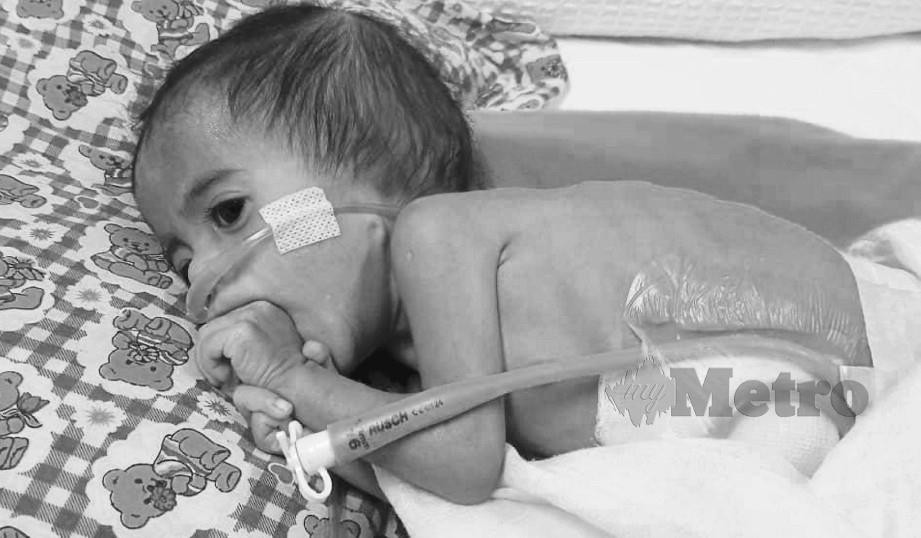 Muhammad Ikhsan Abdul Hadi berusia sembilan bulan, dilahirkan tanpa kedua belah telinga, masalah tulang belakang dan jangkitan paru-paru. 