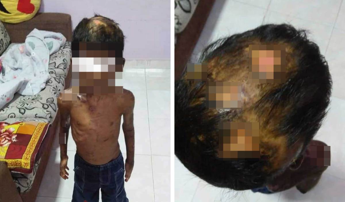SEORANG daripada dua kanak-kanak yang dipercayai menjadi mangsa penderaan pengasuh di Selesa Jaya. FOTO Ihsan keluarga