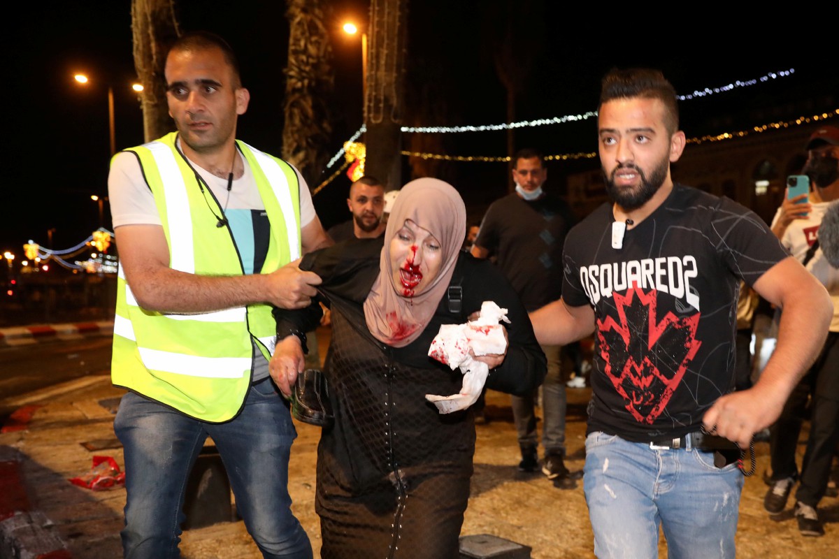 SEORANG wanita Palestin cedera ketika menyertai tunjuk perasaan di Pintu Gerbang Damsyik di Majid Al-Aqsa. FOTO AFP 