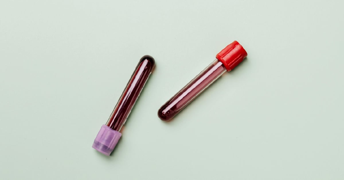 Percubaan klinikal sel darah merah tiruan mula Mac tahun depan