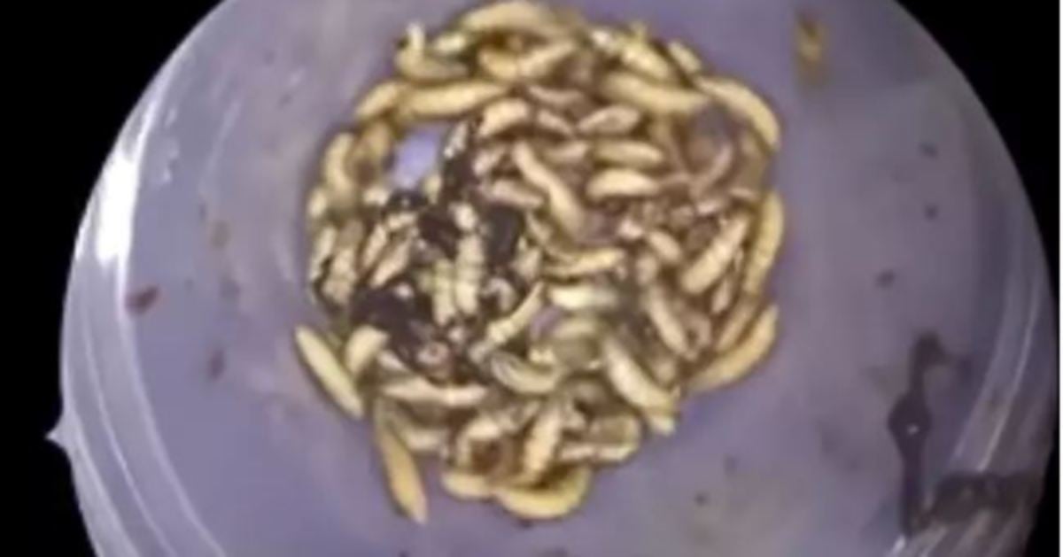 150 larva pepijat dikeluarkan dari hidung lelaki