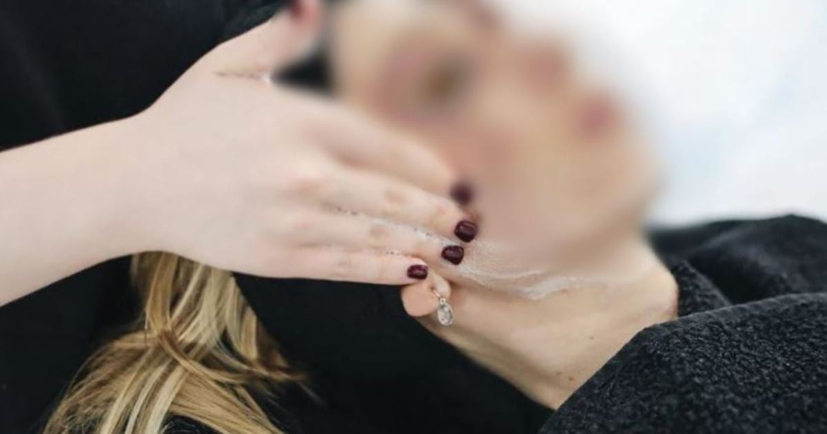 3 wanita dijangkiti HIV kerana 'vampire facials'