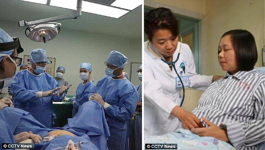 Pasukan doktor yang melakukan pembedahan pada 21 September lalu, terhadap bayi dalam kandungan Xie (gambar kanan)