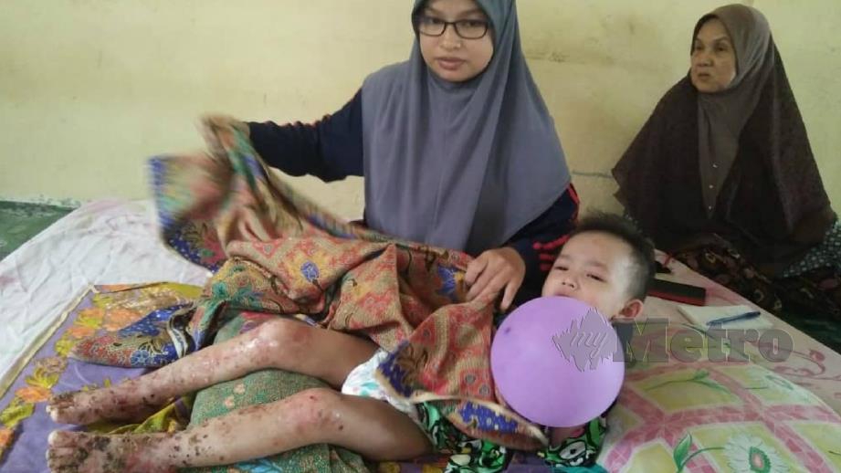 Zainab menunjukkan keadaan anaknya yang menghidap penyakit kulit seluruh badan. FOTO Safuri Kamarudin