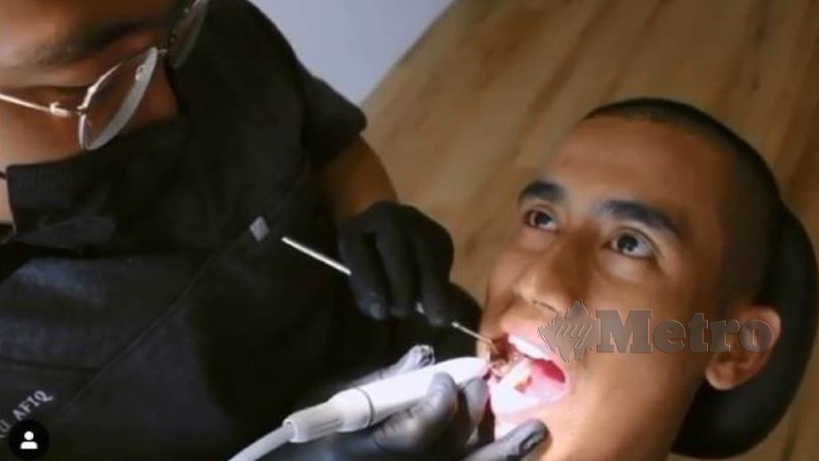 Video pendek Hafizh mendapatkan pemeriksaan di sebuah klinik gigi yang dimuat naik di akaun IG miliknya. Foto Ihsan Hafizh Syahrin Abdullah 