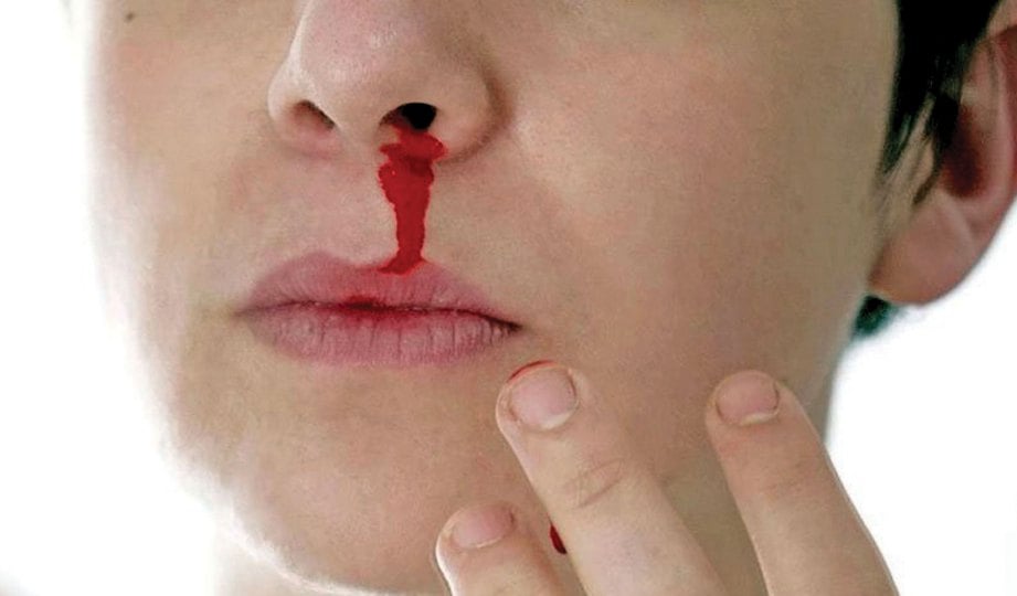 Kenapa hidung berdarah