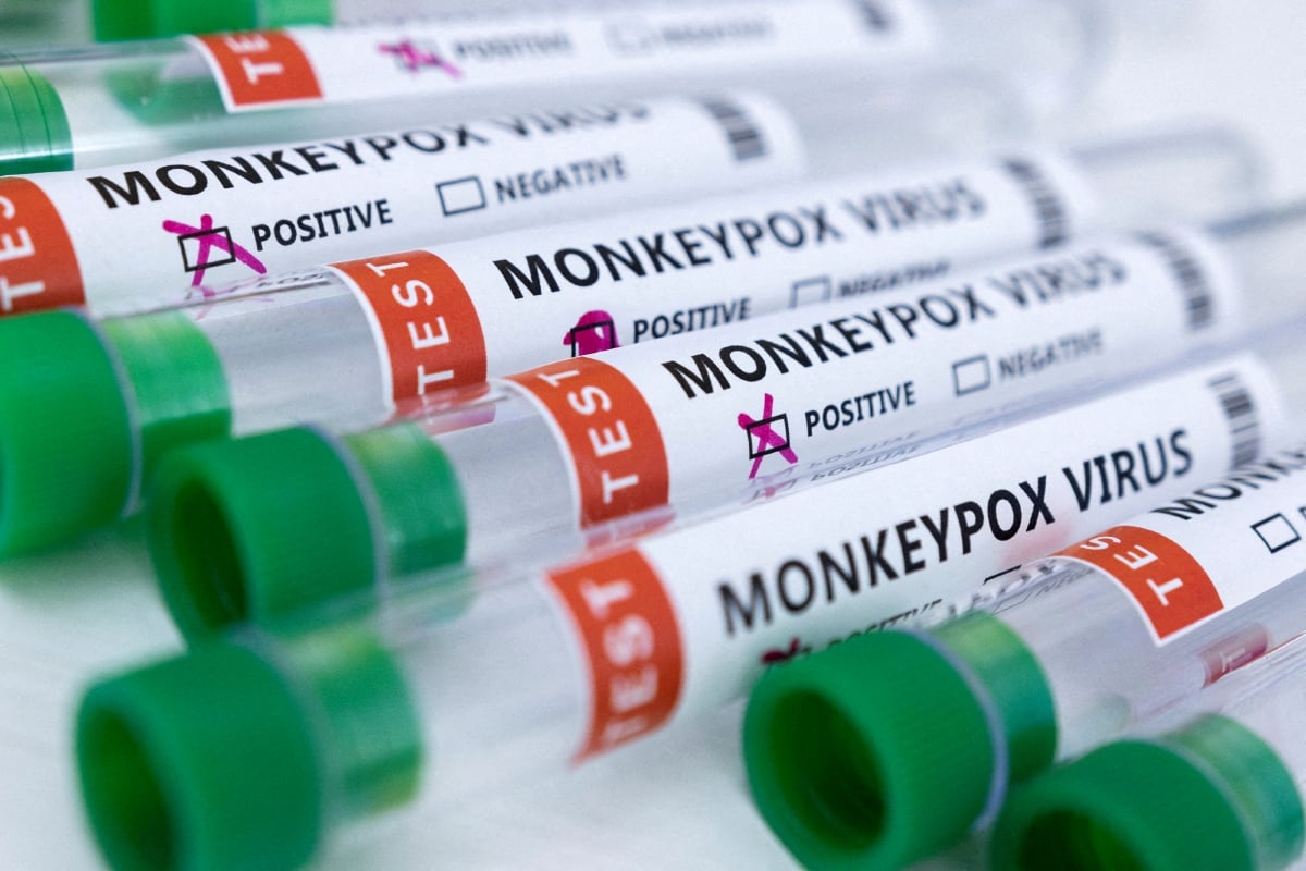 TIUB berisi sampel untuk ujian bagi virus mengesan cacar monyet. FOTO fail Reuters