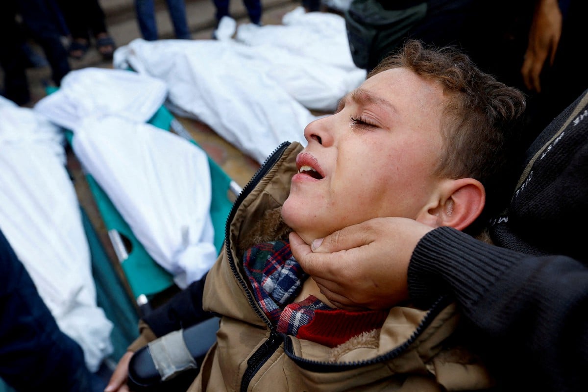 GAMBAR FAIL: Seorang kanak-kanak Palestin yang cedera menghadiri pengebumian ahli keluarga yang terbunuh dalam serbuan serangan Israel. FOTO REUTERS