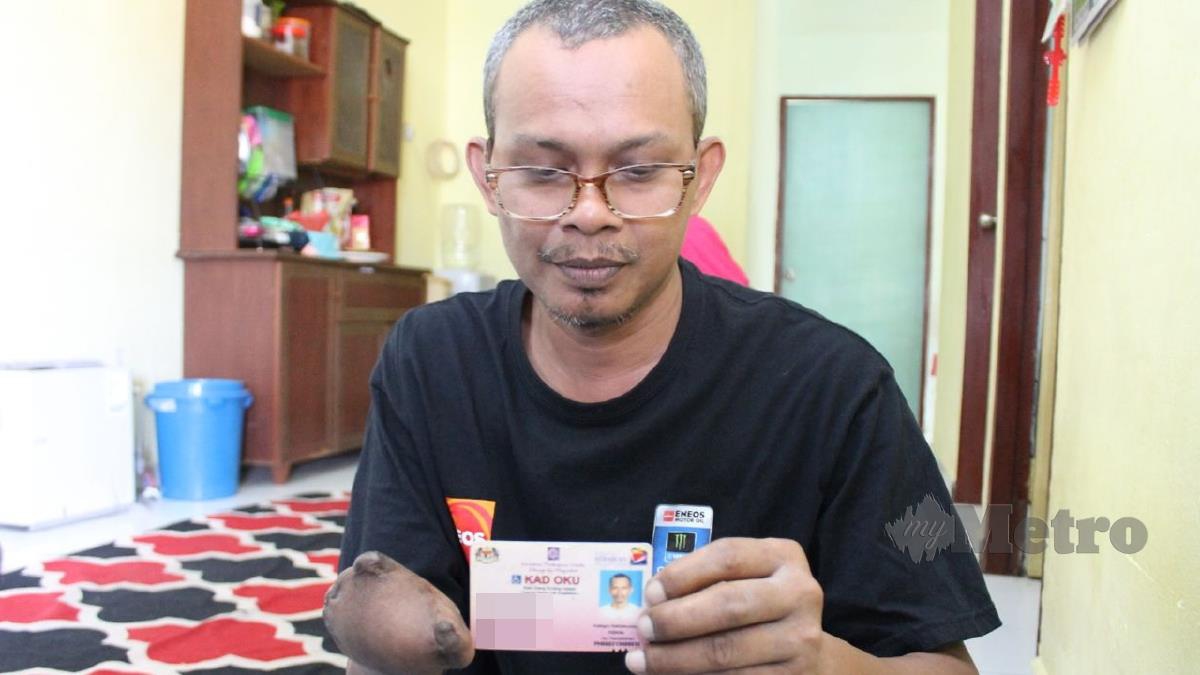 NOR Azmi Bahudin menunjukkan kad OKU dan tangan kanannya tanpa bahagian tapak dan jari kanan. FOTO Mohd Amin Jalil