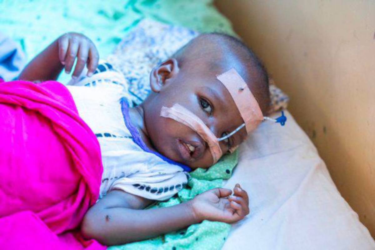 NASRO, kanak-kanak malang di Somalia yang mengalami dehidrasi sehingga tidak dapat mengalirkan air mata.  FOTO Agensi
