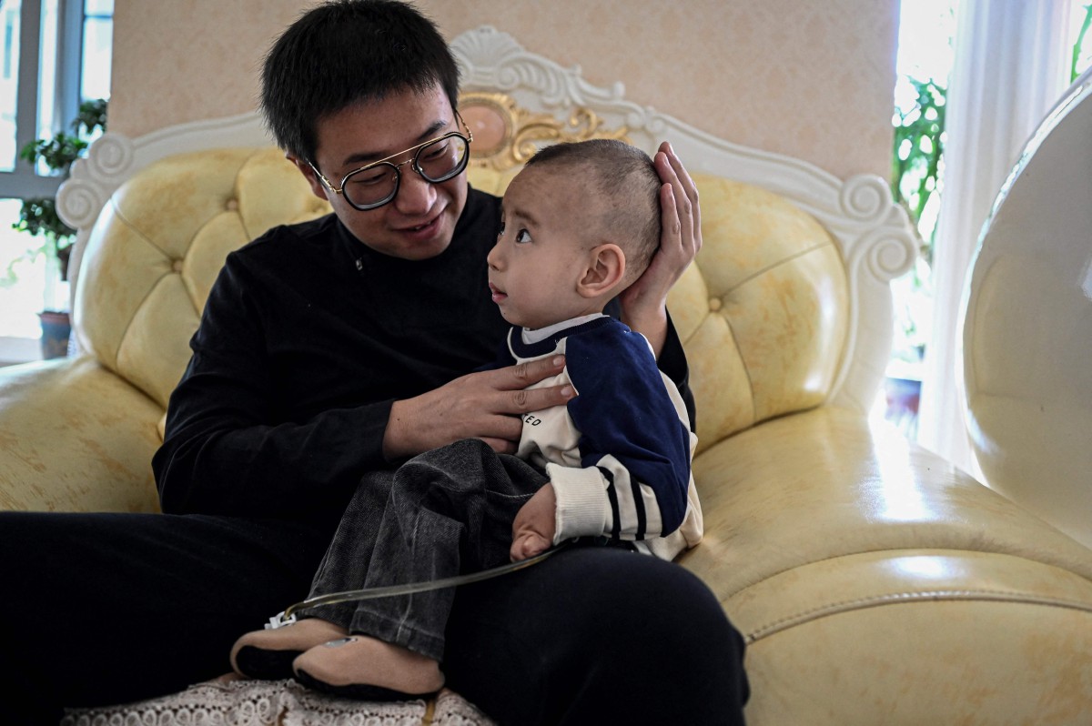 Xu Wei memangku Haoyang yang menghidap sindrom Menkes. - FOTO AFP