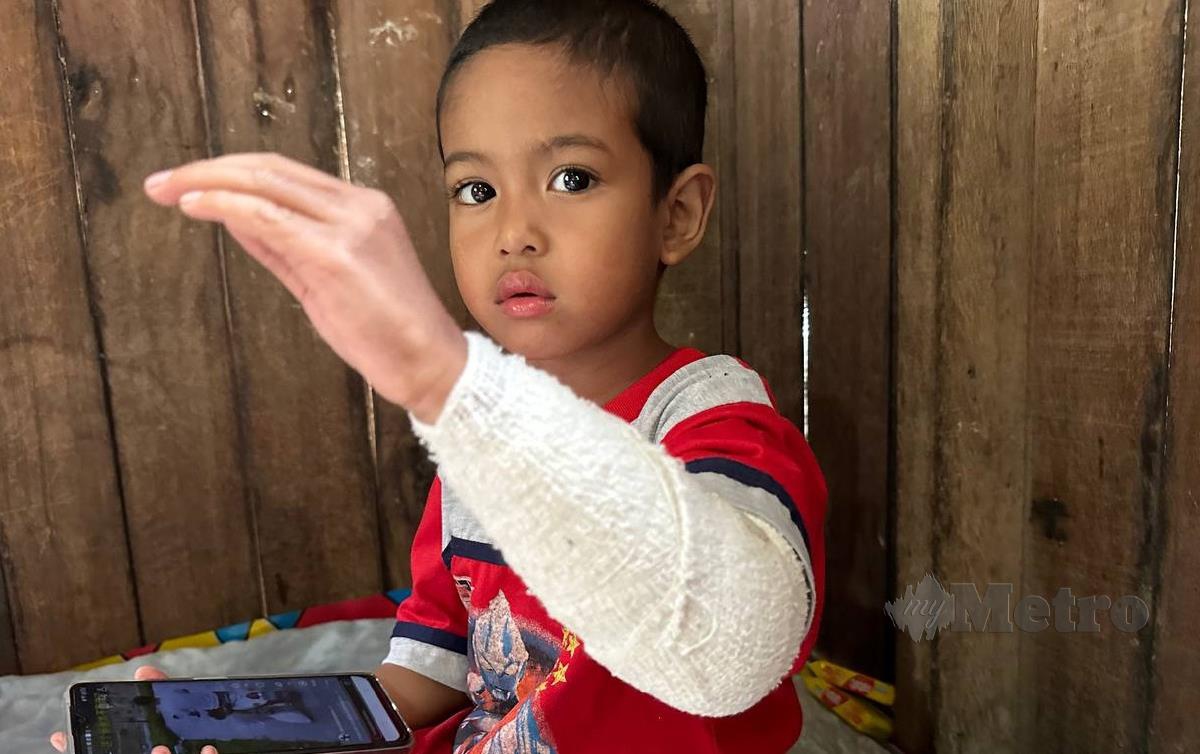 ALIF melihat tangannya yang tercedera ketika ditemui di rumahnya di Kampung Meranto, di sini. FOTO Paya Linda Yahya