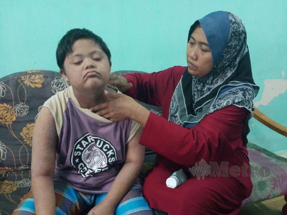 JULIMIYANA Abd Jalil, 42, menyapu ubat krim bagi mengurangkan rasa gatal di tubuh Nurjannah Shaiful. FOTO Mohd Khidir Zakaria
