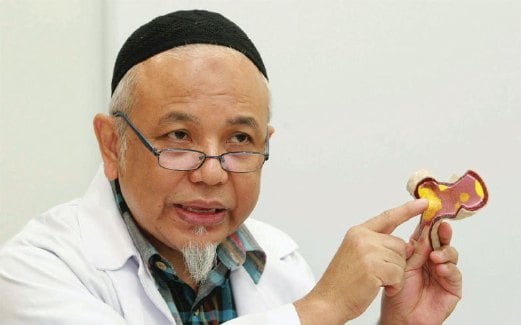 DR Wan Azman menunjukkan pembuluh darah yang tersumbat akibat plak.