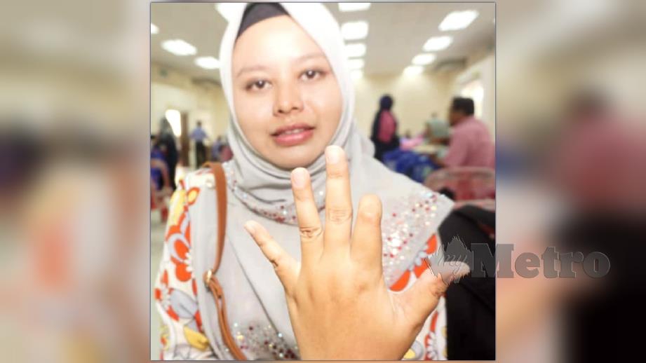 Siti Aisyah menunjukkan jari telunjuk kirinya yang putus akibat terkena mesin pada 2016. FOTO Noorazura Abdul Rahman