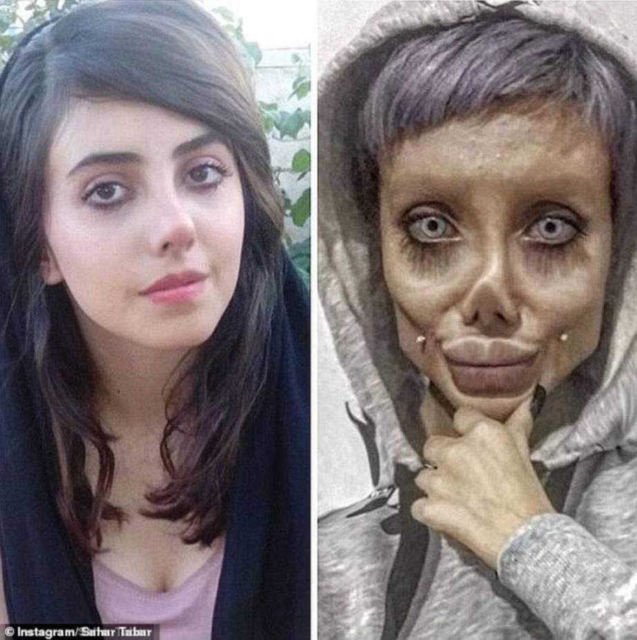 SAHAR Tabar, menunjukkan wajah sebelum dan selepas pembedahan untuk kelihatan seperti Angelina Jolie. FOTO Instagram Sahar Tabar.
