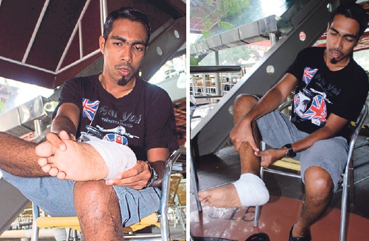 MOHD Suhaimi menunjukkan tumit kakinya yang sakit hingga berlubang.