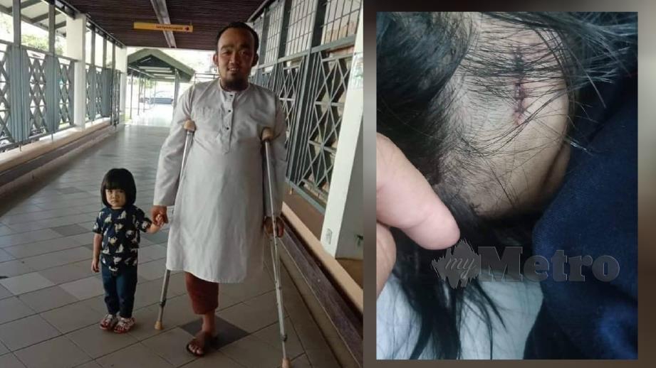 MOHD Sebrie membawa anak bongsunya melawat Nur Annisa di Hospital Miri. (Gambar kanan) keadaan Nur Annisa selepas menjalani pembedahan. FOTO ihsan Mohd Sebrie. 