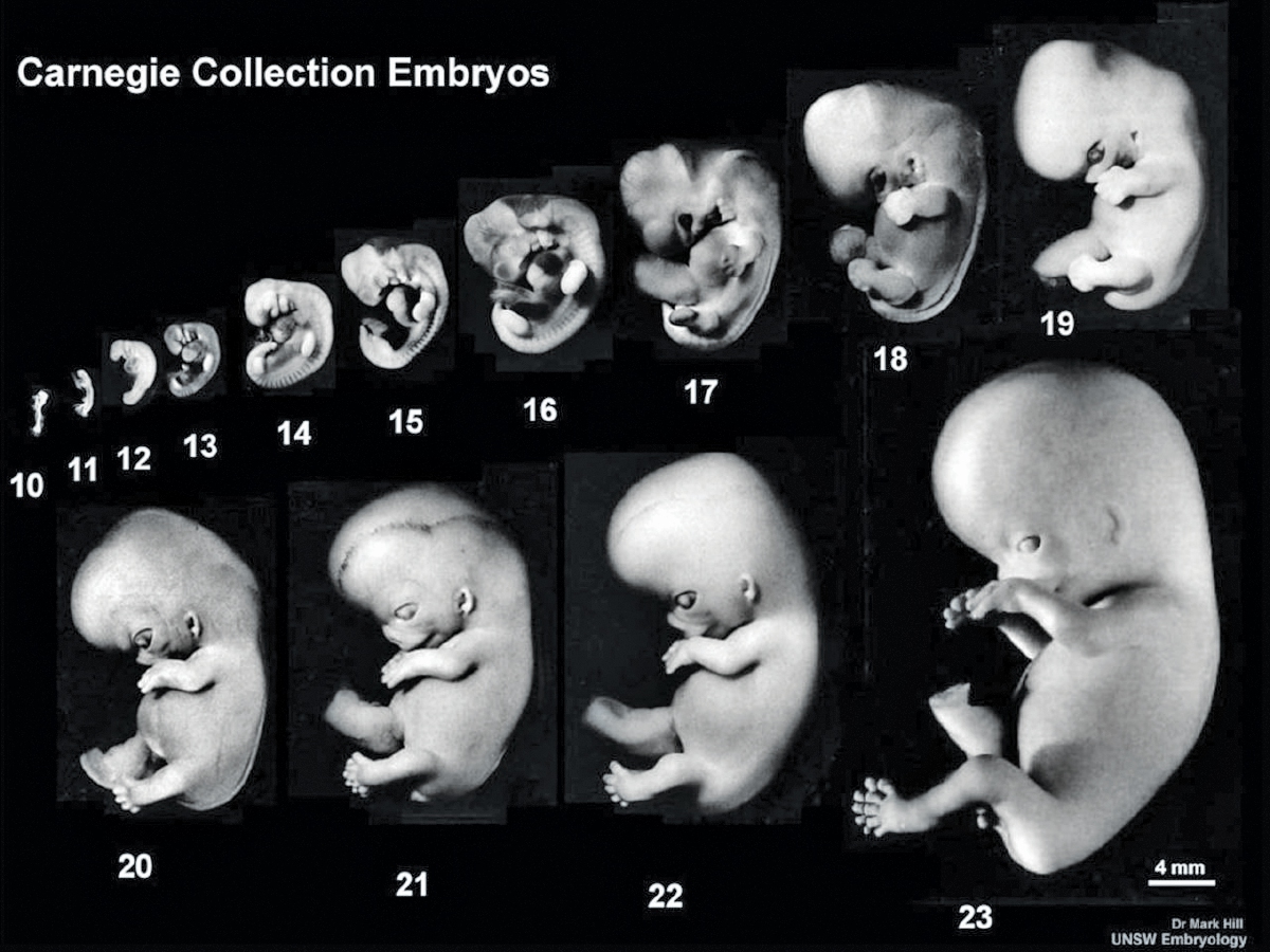 Наличие у зародыша человека. Стадии развития эмбриона. Этапы формирования зародыша человека. Фазы развития эмбриона человека. Стадии развития эмбриона человека.