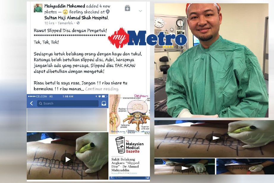 Dr Mahyuddin memberi peringatan di FBnya mengenai rawatan alternatif  masalah tergelincir tulang belakang (slipped disc) dengan cara ketukan yang kini tular di FB. FOTO ihsan Dr Mahyuddin