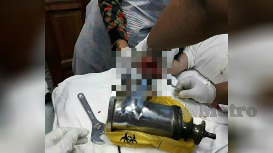 Anggota bomba berusaha mengeluarkan jari mangsa yang tersepit dalam mesin pengisar dalam kejadian di Tanjong Karang, semalam. Foto Ihsan JBPM
