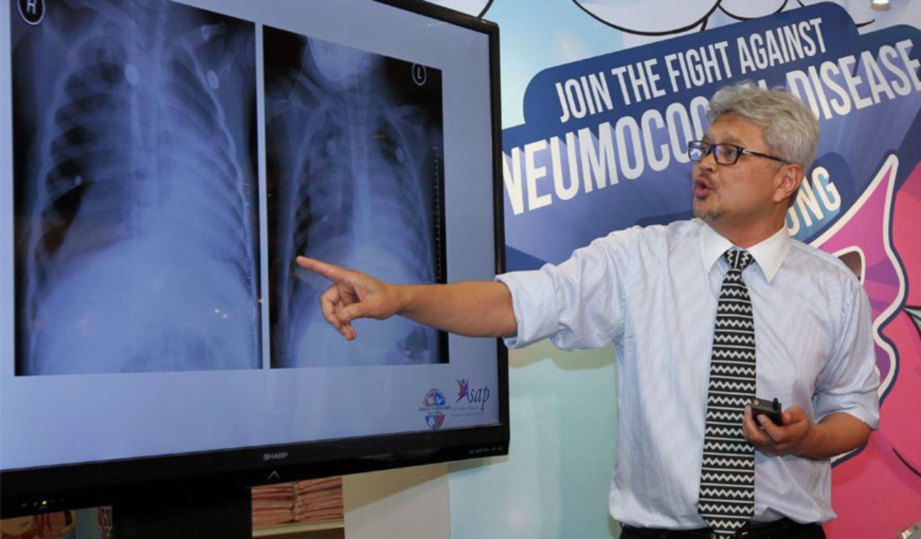 DR MUSA menerangkan mengenai bahaya penyakit pneumokokal.