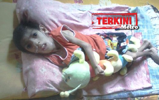 Sejak enam tahun lalu, Mohd Nabiq Haikal Nur Azli yang kini berusia lapan tahun terlantar dengan hanya matanya terbuka akibat menghidap  Cerebral Palsy (CP) dan masalah paru-paru kronik. - Foto Ihsan Keluarga