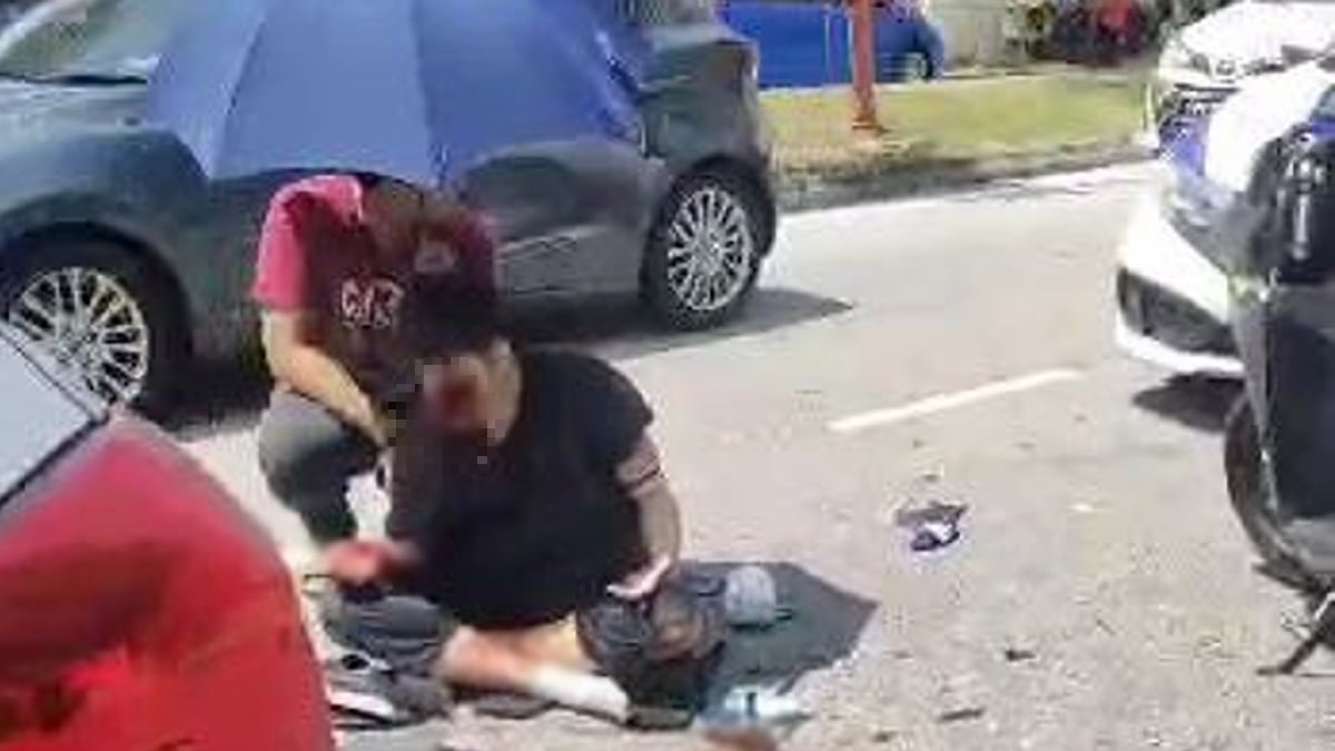 REMAJA parah di muka selepas terbabit kemalangan dengan kereta. FOTO Tular