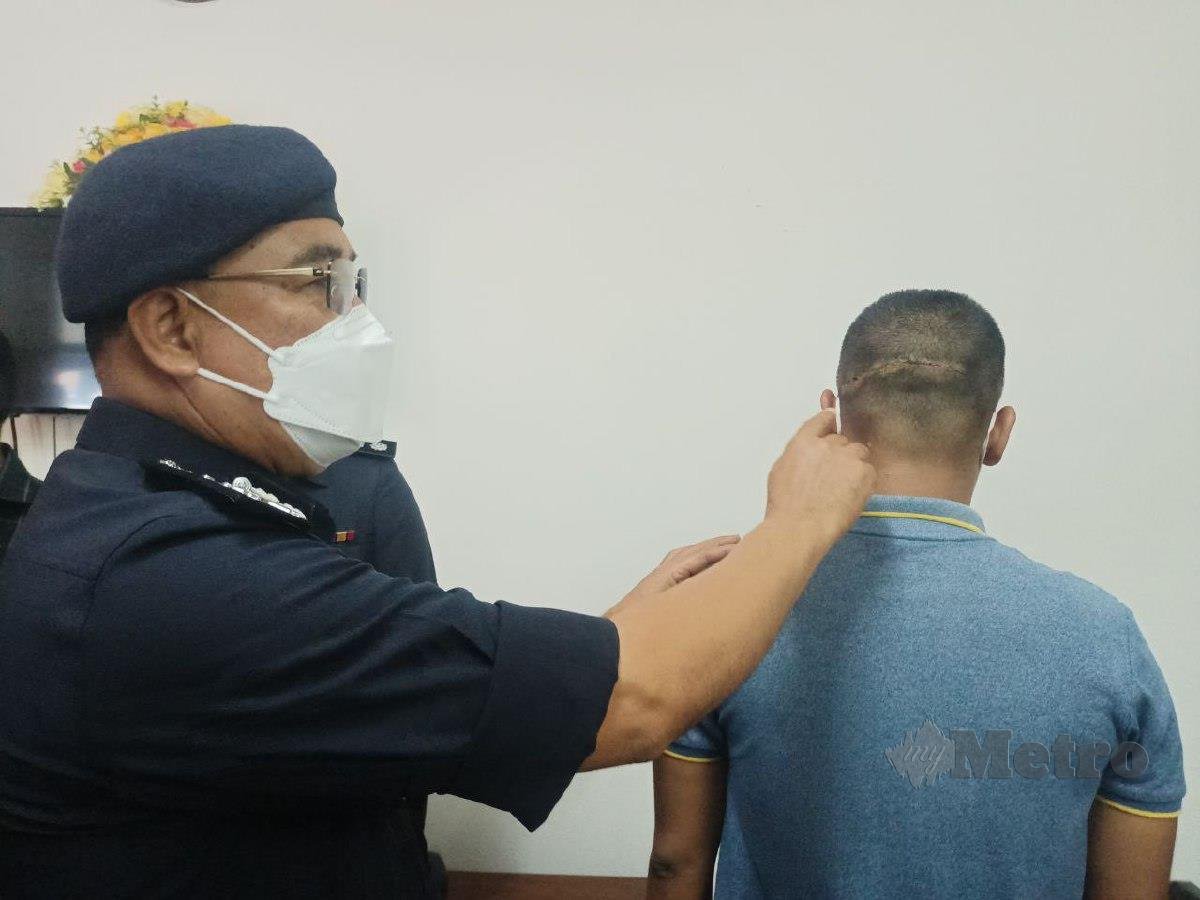 SHAFIEN menunjukkan luka sepanjang sembilan sentimeter di belakang kepala Mohamad Firdaus akibat dilibas dengan parang. FOTO Siti Rohana Idris
