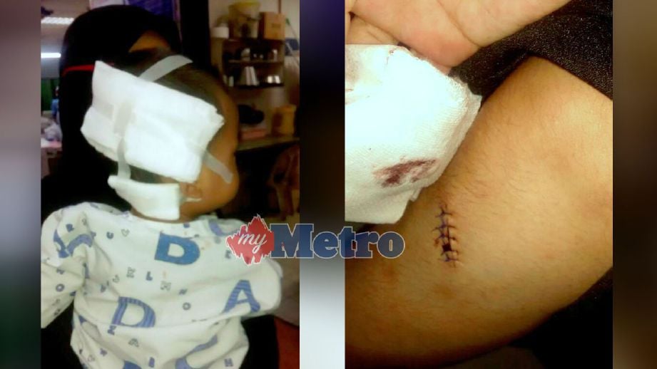  Kanak-kanak berusia setahun cedera di belakang badan dan kepala akibat terkena pisau yang dilibas bapanya di Tehel. (Gambar kanan) Isteri suspek cedera di lengan selepas suami yang tidak bekerja 'naik minyak' melibaskan sebilah pisau. FOTO ihsan pembaca 