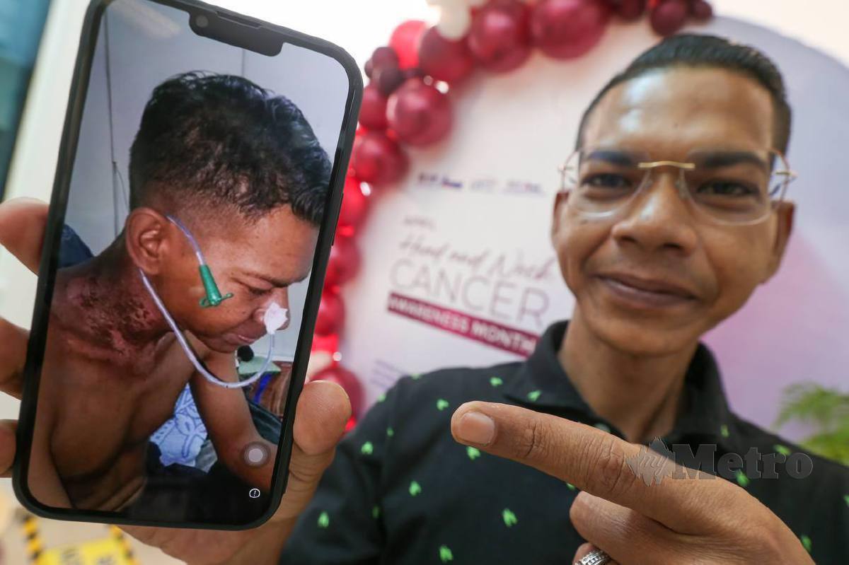 HASBULLAH menunjukkan gambarnya ketika menerima rawatan selepas menghidap kanser kepala dan leher pada 2018 . FOTO Danial Saad