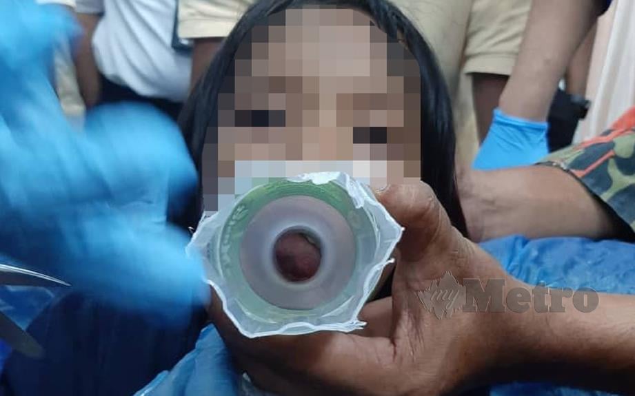 KANAK-KANAK perempuan berusia enam tahun berjaya diselamatkan oleh anggota bomba dan pihak Hospital Baling selepas lidahnya tersepit botol. FOTO IHSAN BOMBA.