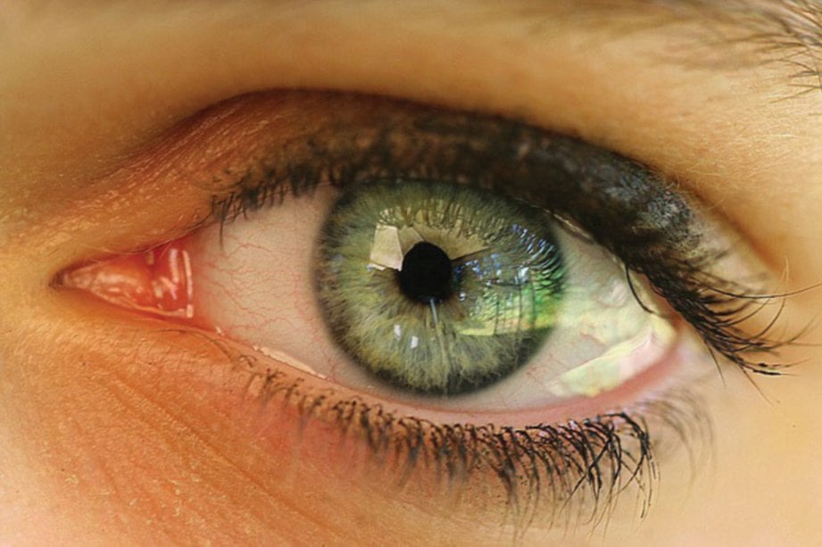 GLAUKOMA adalah penyakit apabila saraf utama mata rosak dan menyebabkan hilang penglihatan.