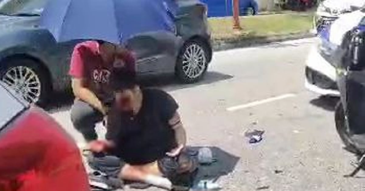 Muka remaja 'koyak' motosikal terlanggar Myvi