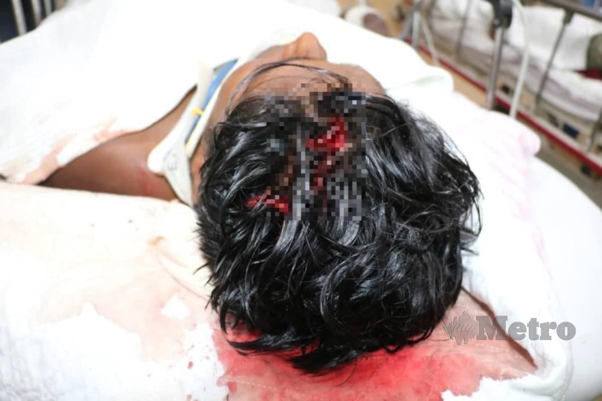 MANGSA cedera diserang lelaki Indonesia. FOTO ihsan polis