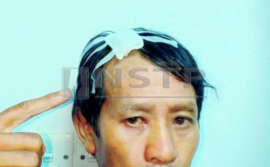 MANGSA yang ditetak anak tirinya mendapat rawatan di Hospital Sibu. FOTO ihsan Polis