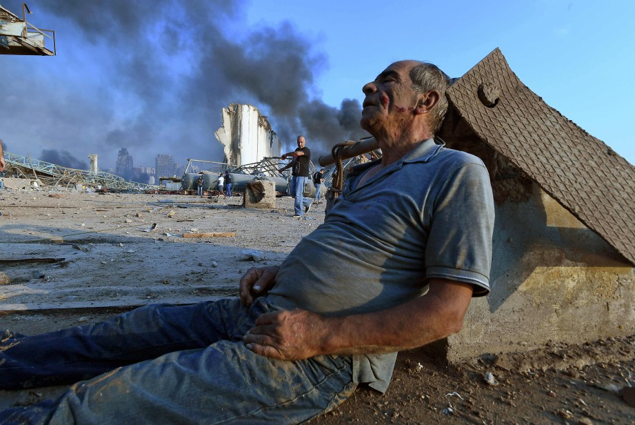 LELAKI yang cedera menunggu bantuan susulan letupan di pelabuhan Beirut. FOTO AFP