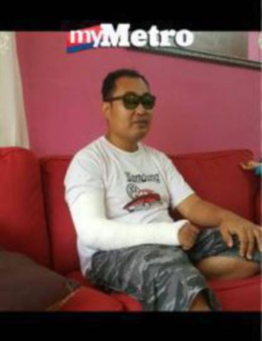 Ismail patah tangan kanan selepas terjatuh di stesen monorel Tun Sambanthan. PIX ihsan Ismail