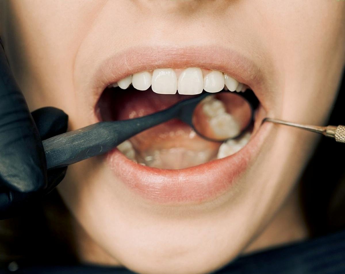 PEMERIKSAAN gigi perlu dilakukan antara tiga hingga enam bulan jika anda penghisap vape atau rokok.