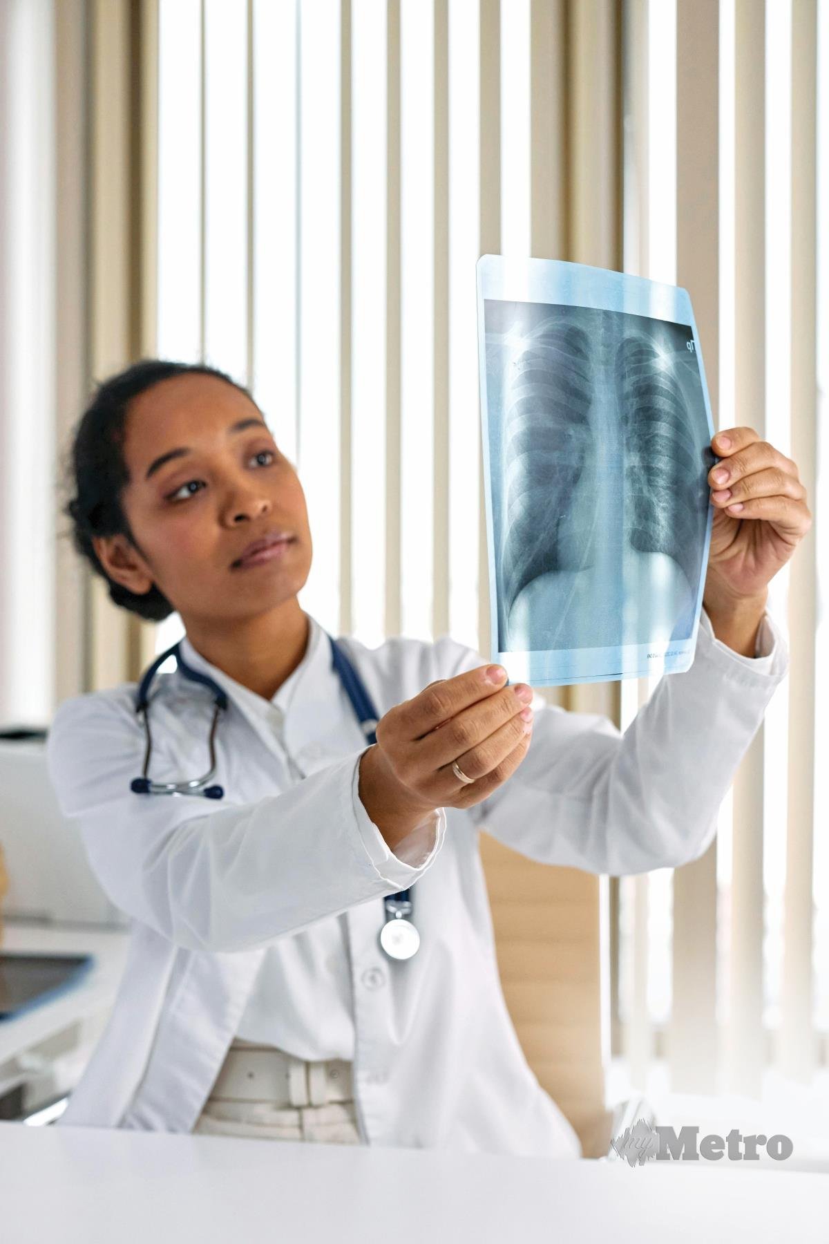 IMBASAN sinar X-ray dilakukan jika ada gumpalan cecair akibat saluran darah yang rosak akibat denggi.
