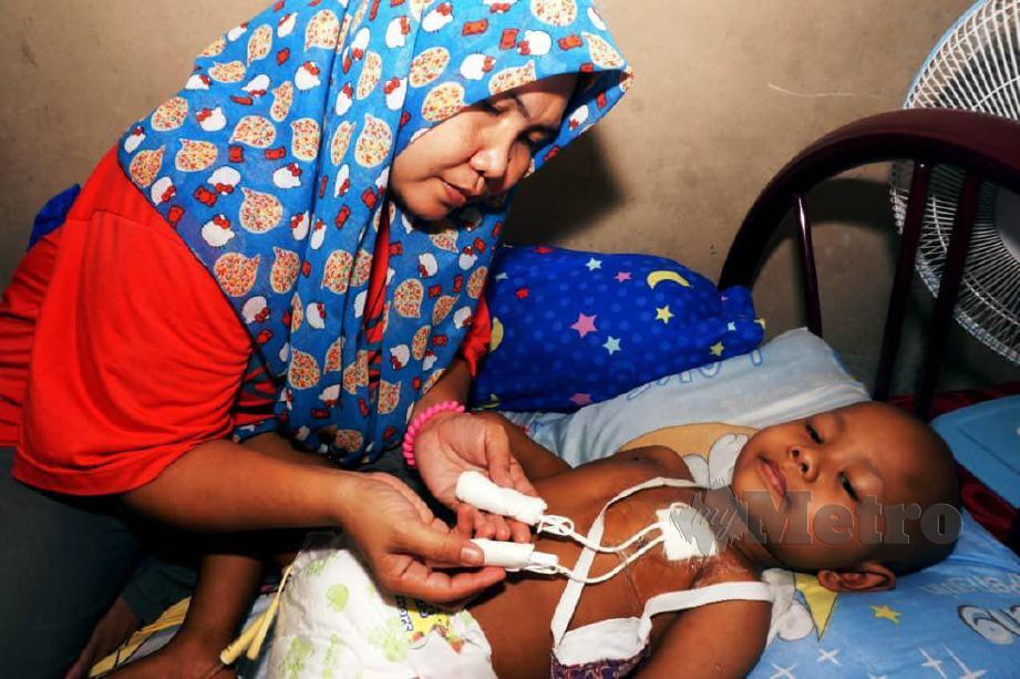 Nor Asnah Asmo,36, menunjukkan tapak kimoterapi yang dipasang pada bahagian dada anaknya, Muhammad Muazzudin Mohd Hayat,3, yang mengidap kanser neuroblastoma tahap empat di rumah mereka di Kampung Telok Nibong, Jitra, di sini. FOTO Noorazura Abdul Rahman