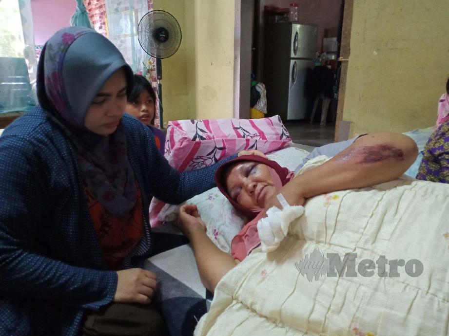 Asmah mengalami kecederaan pada muka dan jari tangan kiri akibat dirempuh babi sambil diperhatikan anaknya, Siti Nor Shafiqah Mohd Nor, 32. FOTO AHMAD RABIUL ZULKIFLI