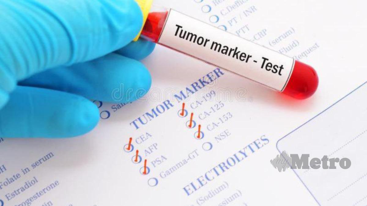 LAKUKAN ujian darah dan penanda tumor sebagai ujian tambahan ketika pemeriksaan untuk kanser payudara dan kanser kolorektal bagi mendapatkan diagnosis yang lebih tepat.