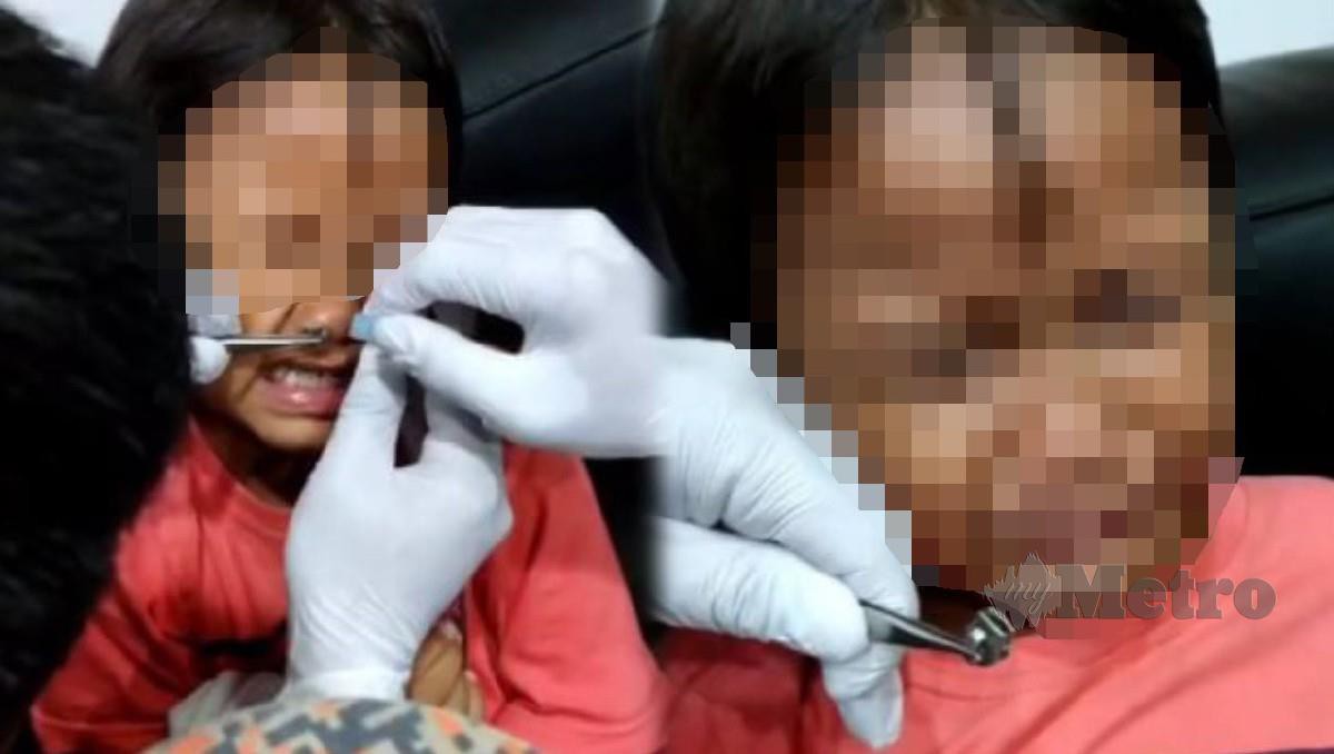 ANGGOTA bomba membantu mengeluarkan kepala zip yang tersangkut dalam hidung kanak-kanak. FOTO Ihsan Bomba 