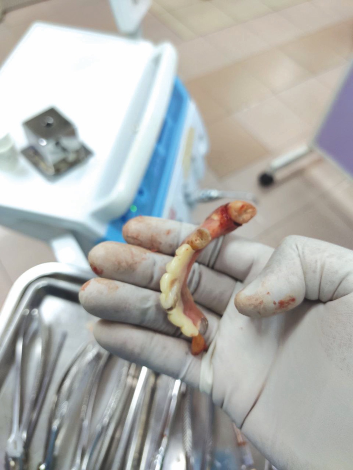 JANGAN ambil risiko mendapatkan rawatan pergigian daripada ‘doktor gigi haram’. 