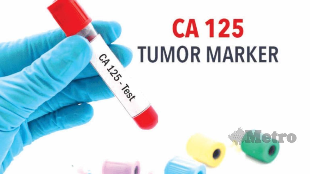 IMBASAN transvaginal dan ujian penanda tumor CA 125 digunakan untuk mengesan kanser ovari tetapi dengan limitasi. 