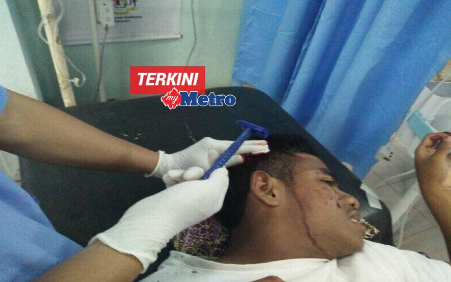 Mangsa yang cedera di kepala menerima rawatan di Pusat Kesihatan Bandar Chiku, semalam. FOTO ihsan pembaca